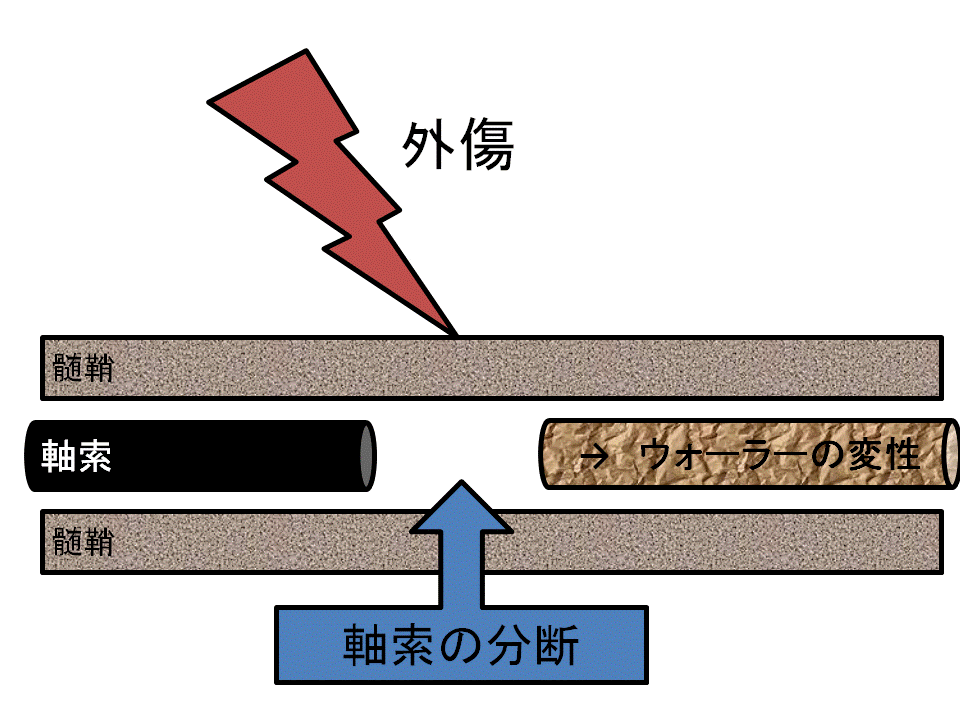 アクソノトメーシス