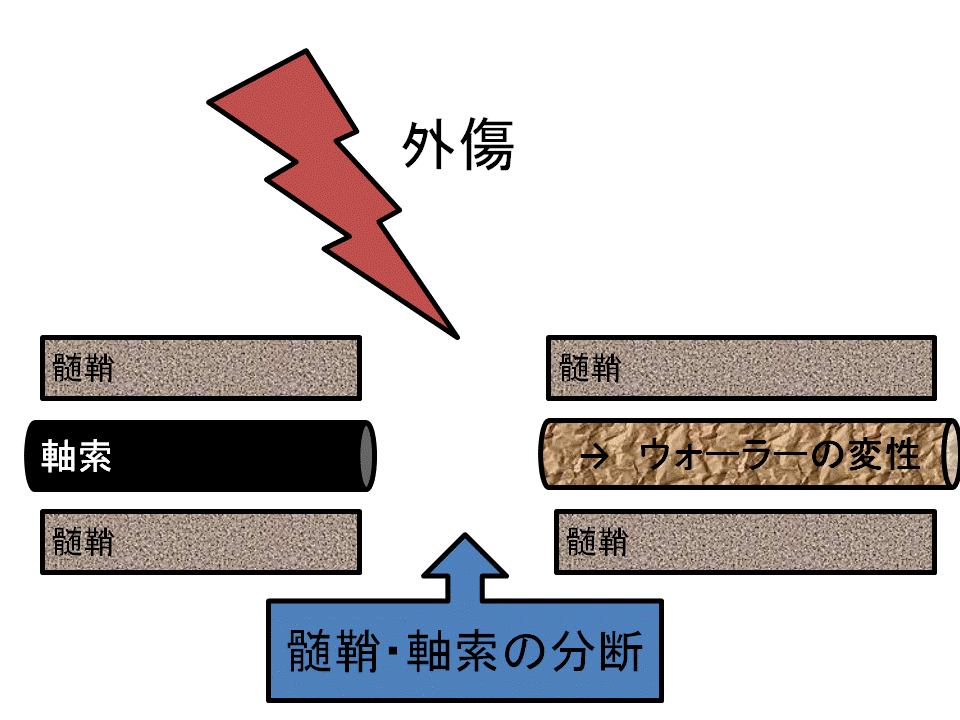 ニューロトメーシス